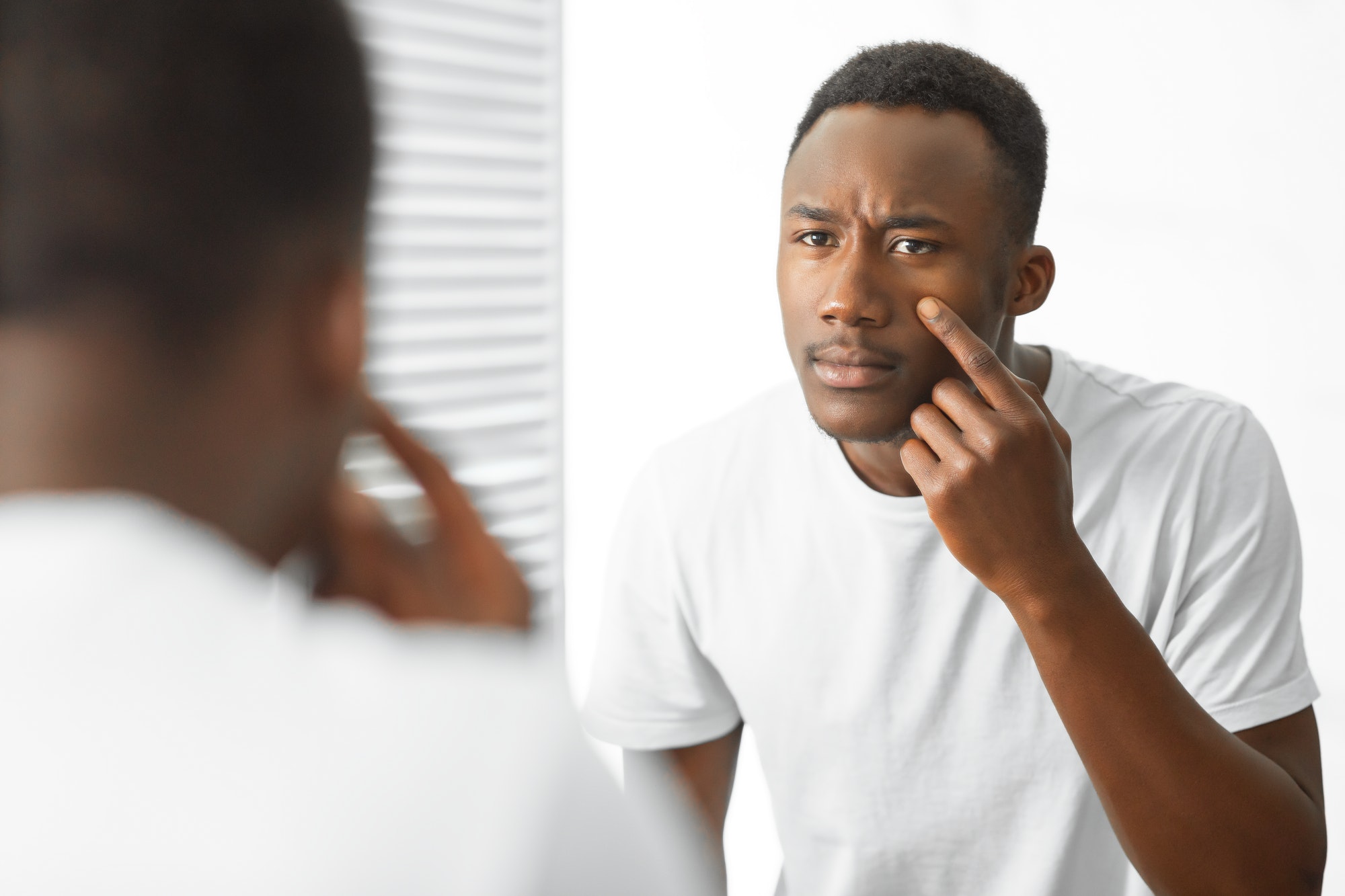 Worried Black Guy Touching Acne On Face Standing In Bathroom